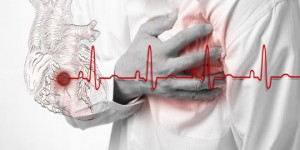 Global Well-Known Victims of Heart Attacks